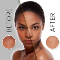 Before and after makari soap